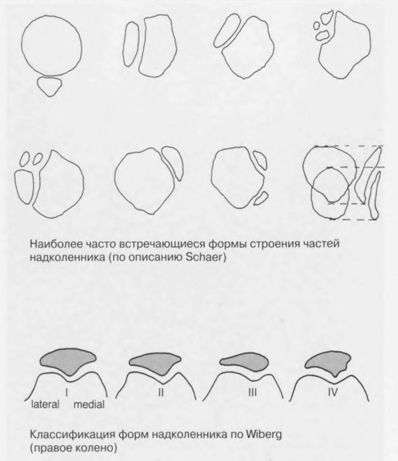 Перелом надколенника карта вызова скорой медицинской