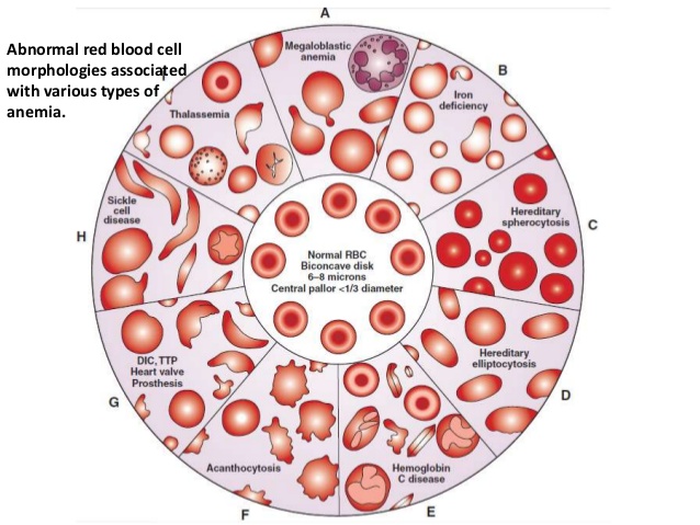 Повышенное распределение эритроцитов. Эритроциты RBC В крови. Аннулоциты-кольцевые эритроциты. Клетки крови несущие групповую принадлежность. Blood Cell Morphology.