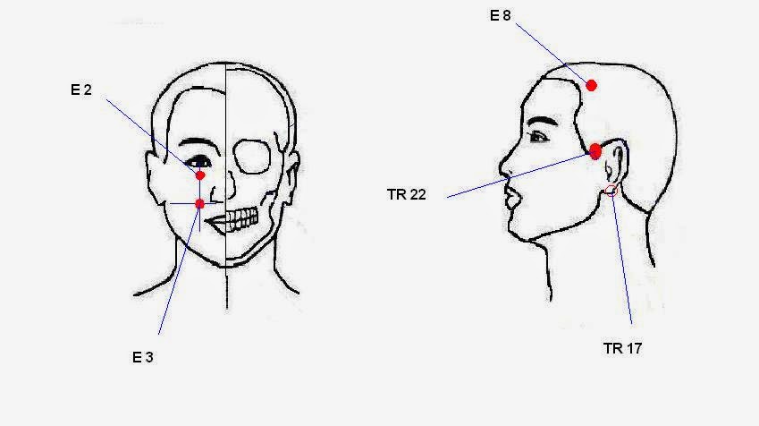 Как отличить зубную боль от тройничного. Точки шиатсу от зубной боли. Точки акупунктуры зубная боль. Точки на лице от зубной боли. Точки для массажа от зубной боли.