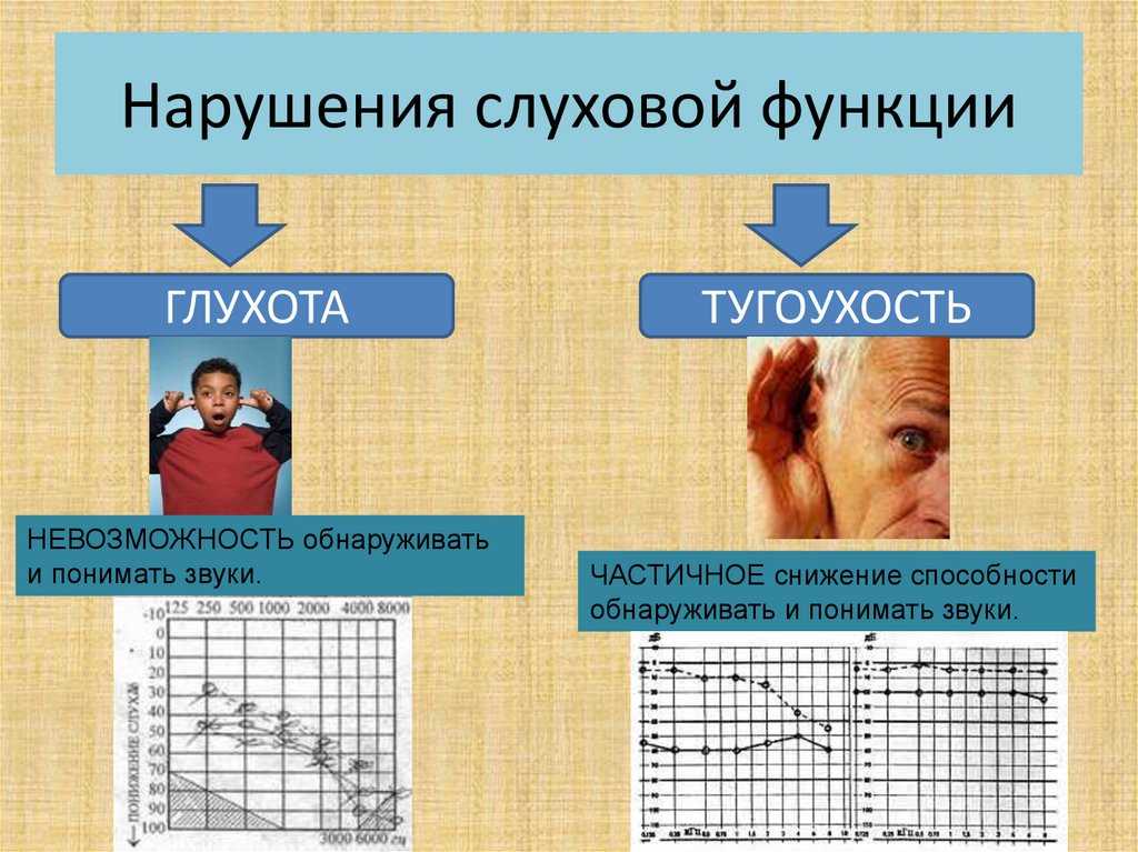 Кондуктивная и смешанная тугоухость