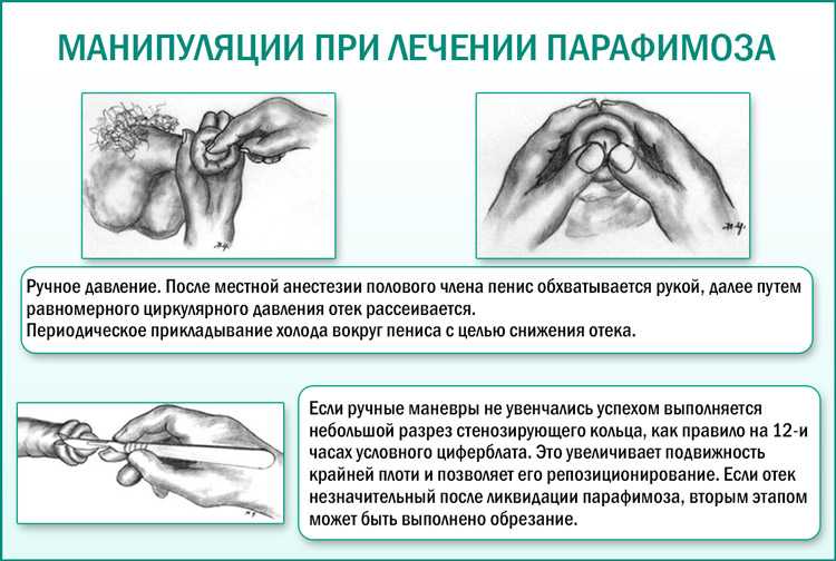 Обрезание Закуцкий Фото После Операции Спб