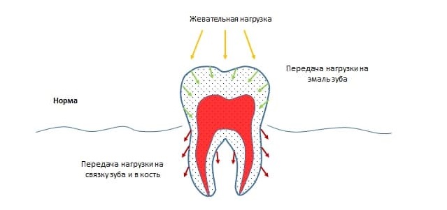 Интактный зуб это. Феррул зуба в стоматологии. Феррул эффект в стоматологии. При остром течении кариеса зубов дентин имеет цвет:.