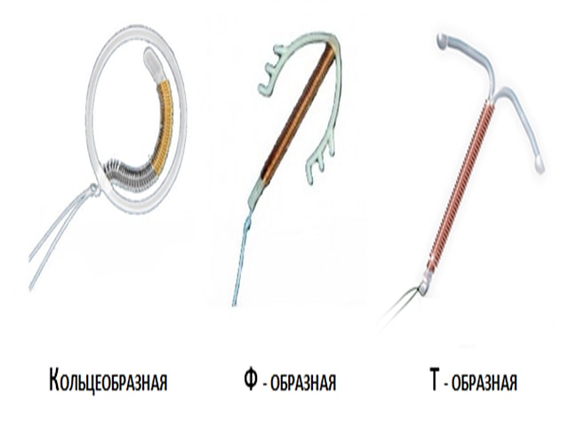 Образная спираль. Спираль внутриматочная кольцеобразная. Противозачаточные спирали кольцеобразное. О образная спираль внутриматочная. Спираль подкова внутриматочная.
