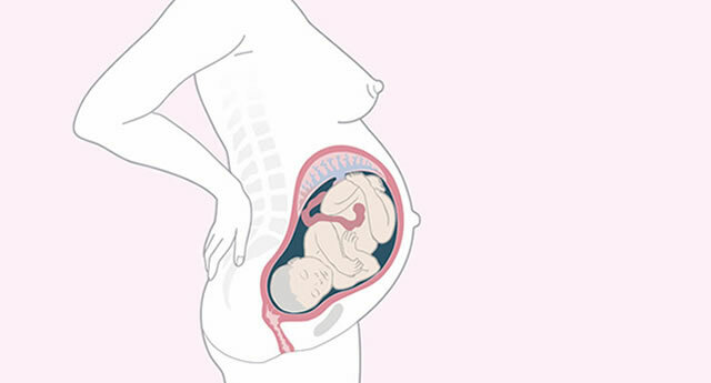 Как рожать побыстрее 39 неделя. Расположение ребенка на 34 неделе беременности. Малыш на 34 неделе беременности в утробе. Малыш в животе 34 неделе беременности. Расположение плода на 34 неделе беременности.