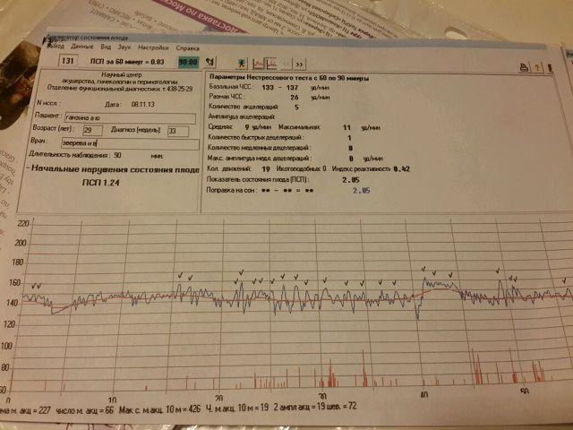 КТГ допплер при беременности. ПСП 001 КТГ. Что такое КТГ И допплерометрия. Плохое КТГ.