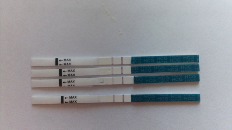 Тест после внематочной. Внематочная беременность тест. Внематочная тест 2 полоски. Внематочная беременность покажет ли тест на беременность. Внематочная видно на тесте.