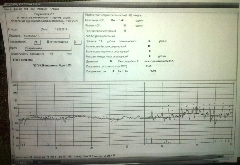 Ктг на 39 неделе беременности