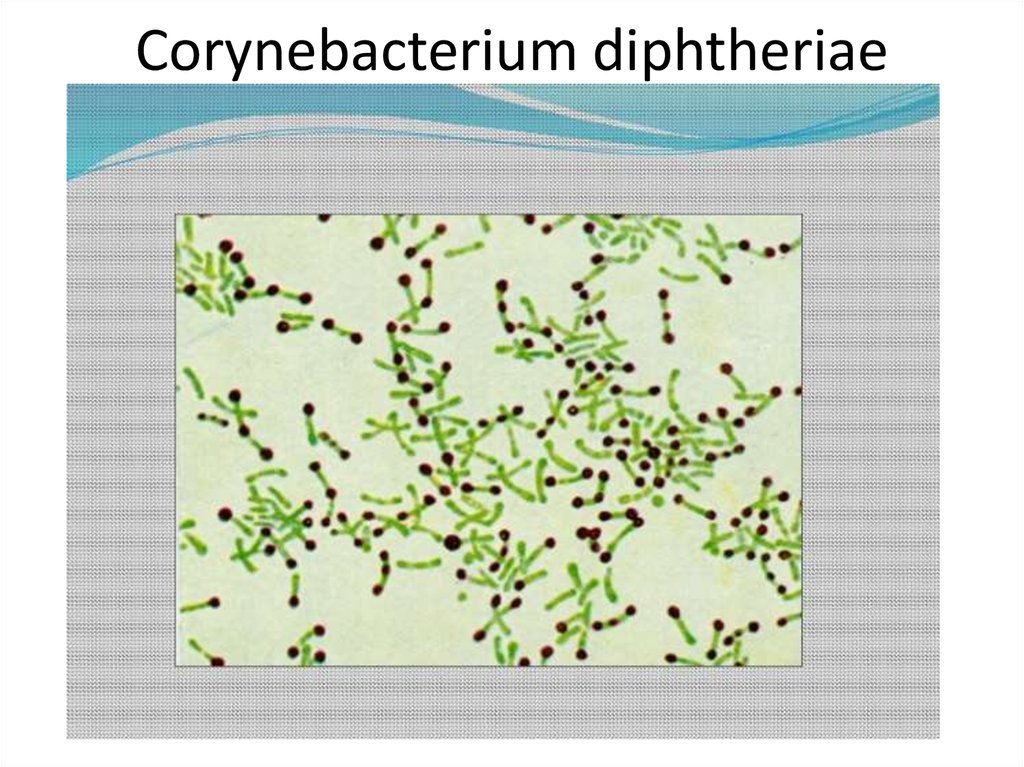 Возбудители дифтерии являются. Дифтерийная палочка Corynebacterium diphtheriae. Коринобактерии дифтерии морфология. Corynebacterium diphtheriae чистая культура. Коринебактерии дифтерии по Леффлеру.