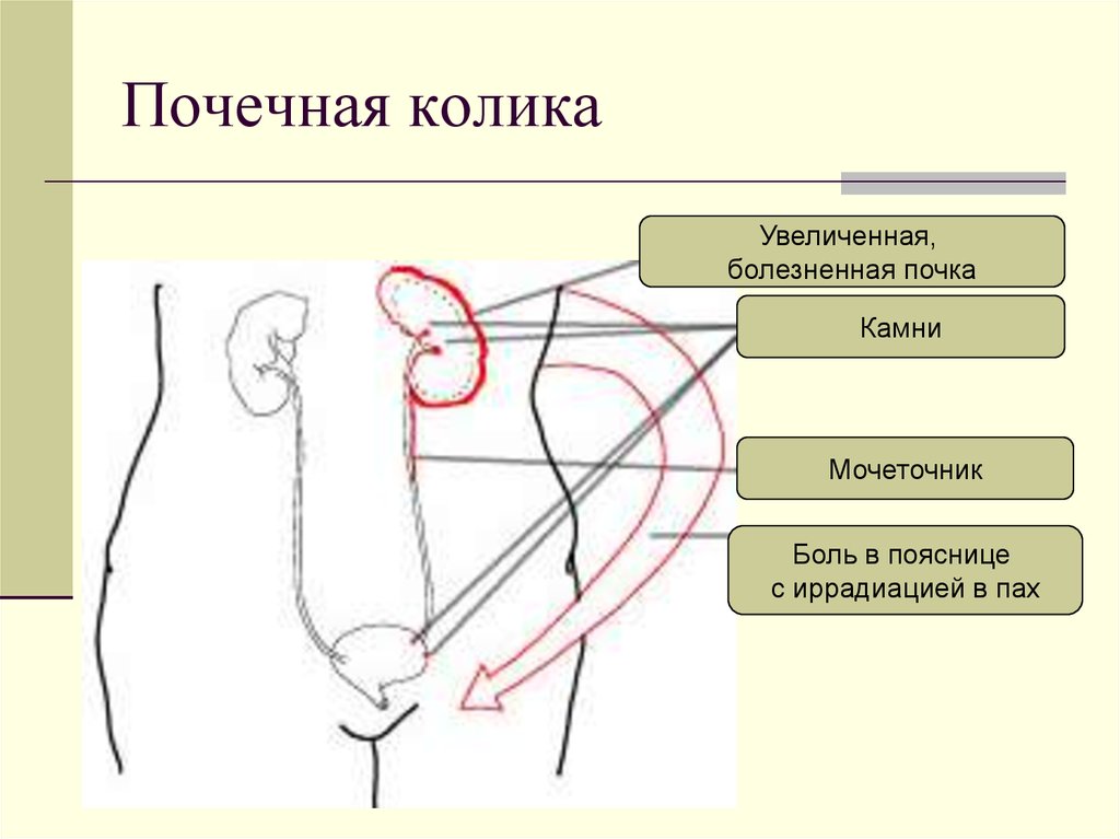 Левый пах у мужчин