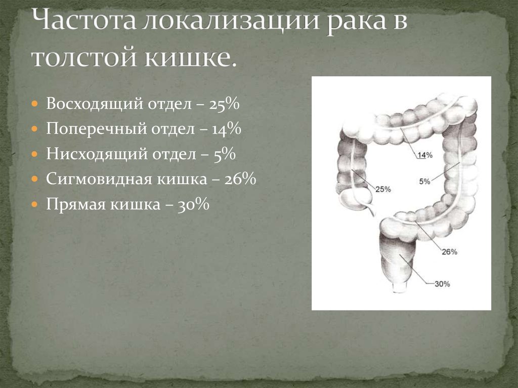 Рак сигмовидной кишки карта вызова смп