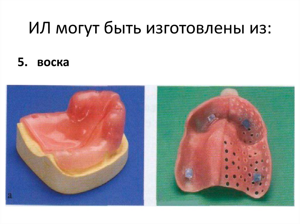 Индивидуальная ложка. Индивидуальная ложка для ПСП. Индивидуальная ложка для съемного протеза. Индивидуальная ложка для полного съемного протеза. Индивидуальная ложка для частично съемного протеза.