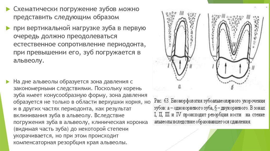 Резорбция это. Тканевые преобразования при ортодонтическом перемещении зубов. Корпусное перемещение зуба. Вертикальное перемещение зубов.