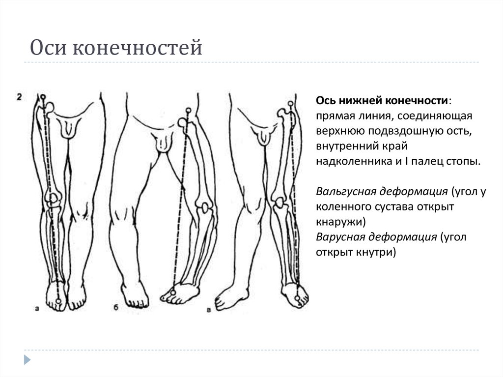 Нижний определенный