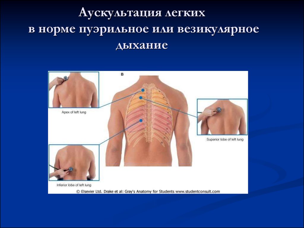 Точки аускультации легких картинки