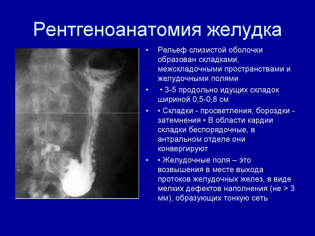 Пищевод складки слизистой. Рельеф слизистой оболочки желудка рентген. Рентгеноанатомия желудка. Рентгеноанатомия пищевода и желудка.