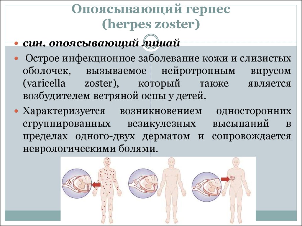 Герпес На Теле Лечение Фото