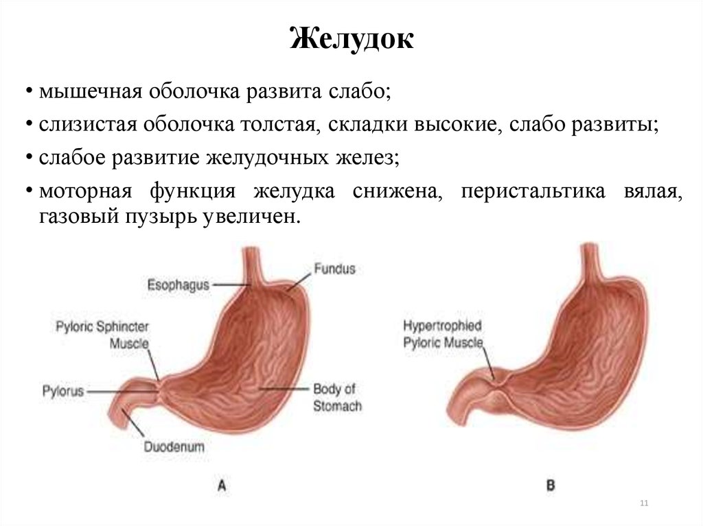 Что означает желудков. Вялая перистальтика желудка. Перельстатика желудка.