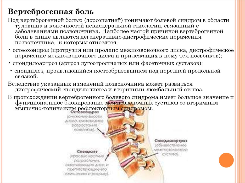 Дистрофические изменения гоп. Дорсопатии поясничного отдела позвоночника. Рефлекторные синдромы остеохондроза поясничного отдела. Дорсопатии шейного отдела позвоночника. Дорсопатия позвоночника остеохондроз.