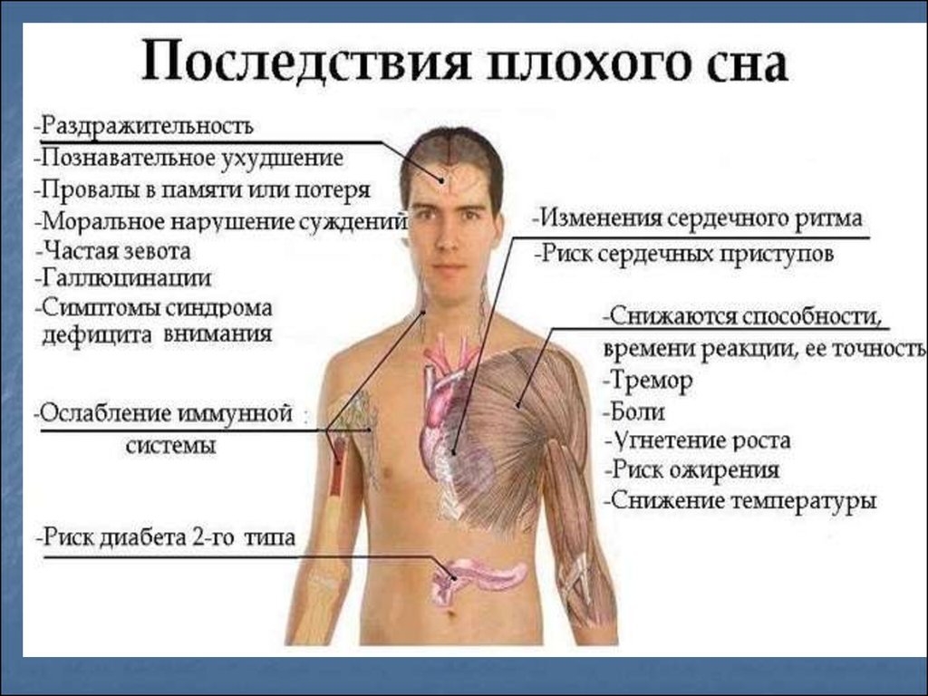 Почему после сна. Последствия бессонницы. Симптомы плохого сна. Последствия плохого сна. Причины нарушения сна.