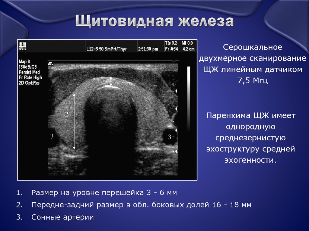 Щитовидная железа узи норма. Структура нормальной щитовидной железы на УЗИ. Щитовидная железа УЗИ замеры. Ультразвуковое исследование щитовидной железы норма Размеры. Ширина и толщина щитовидной железы на УЗИ.