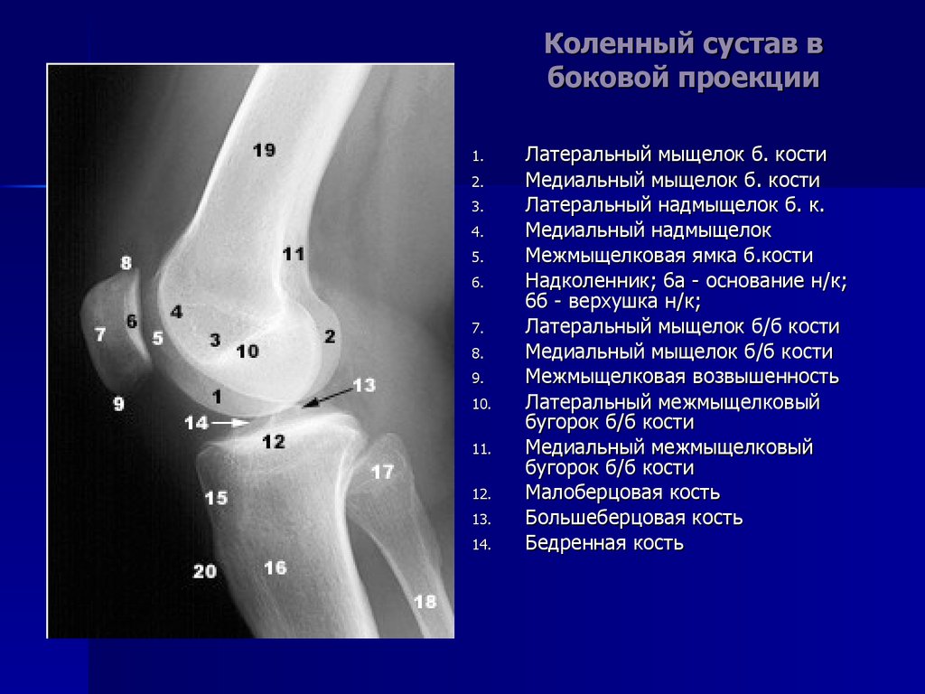 Какой сустав изображен. Коленный сустав рентген анатомия. Коленный сустав в боковой проекции анатомия. Рентген коленного сустава в боковой проекции. Коленный сустав строение анатомия рентген.