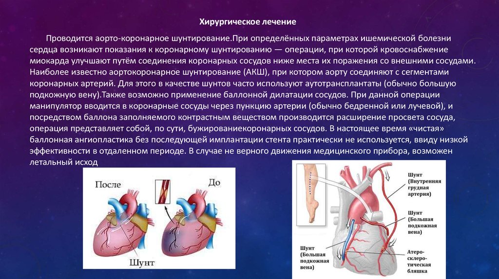 Что такое шунтирование сердца и сосудов. Аортокоронарное шунтирование при ИБС. Шунтирование коронарных артерий показания. Операции при ишемической болезни сердца.
