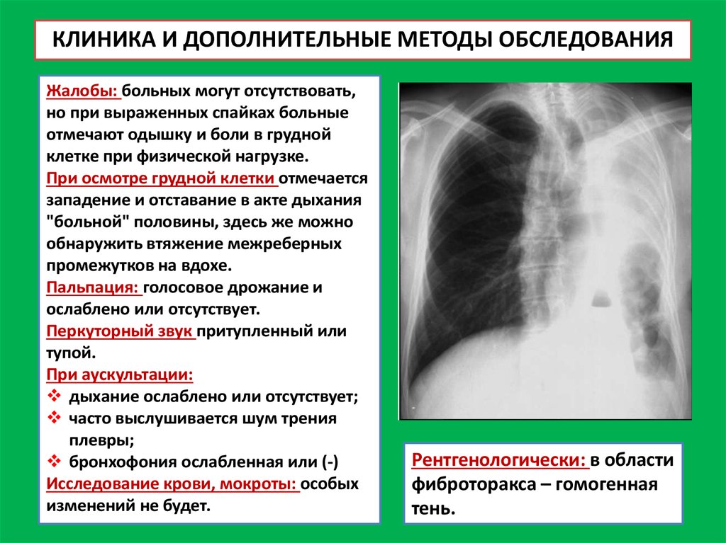 При плеврите растяжению спаек способствуют упражнения