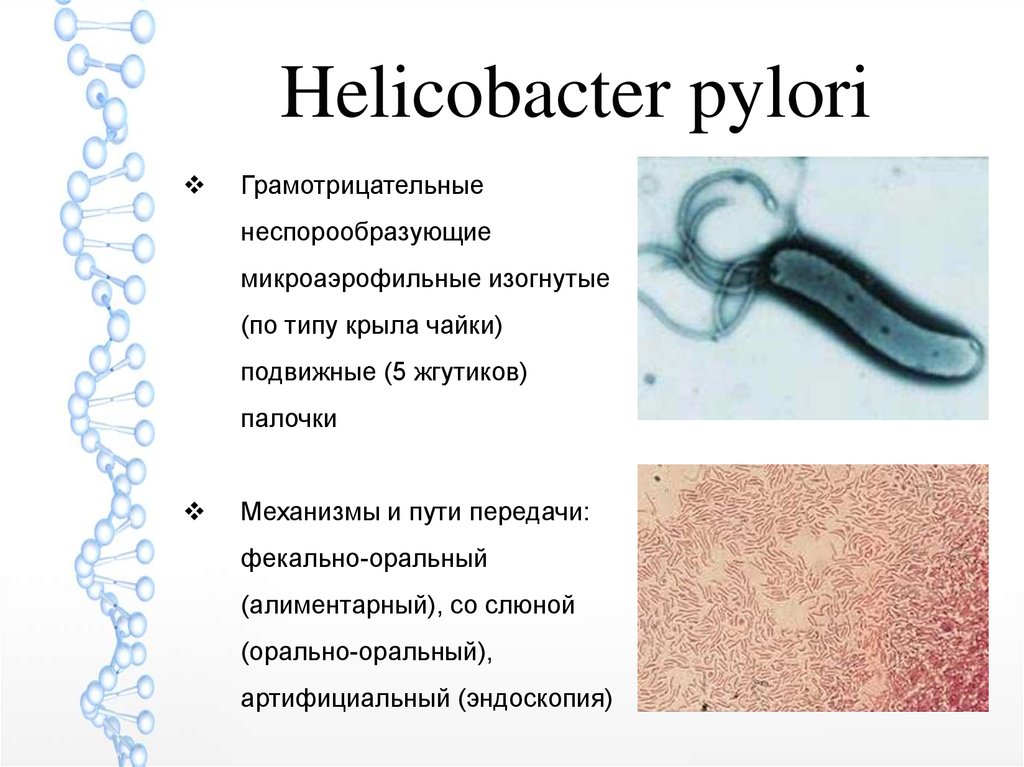 Tratamiento helicobacter pylori opiniones