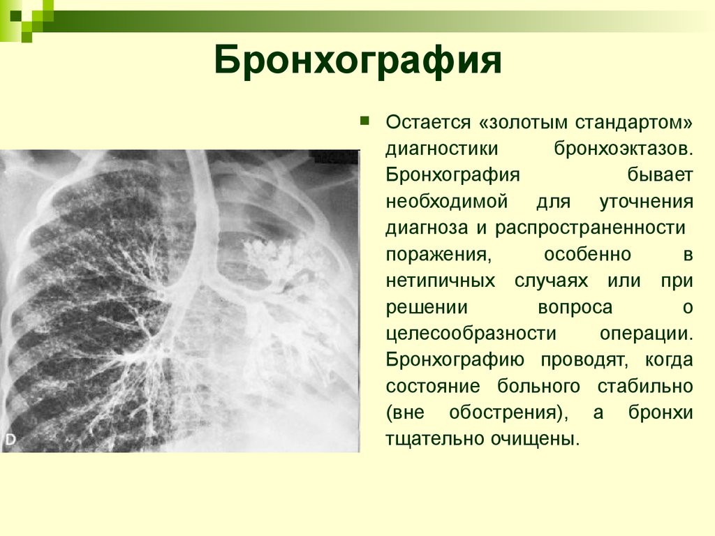 Легочный рисунок усилен что это значит у ребенка