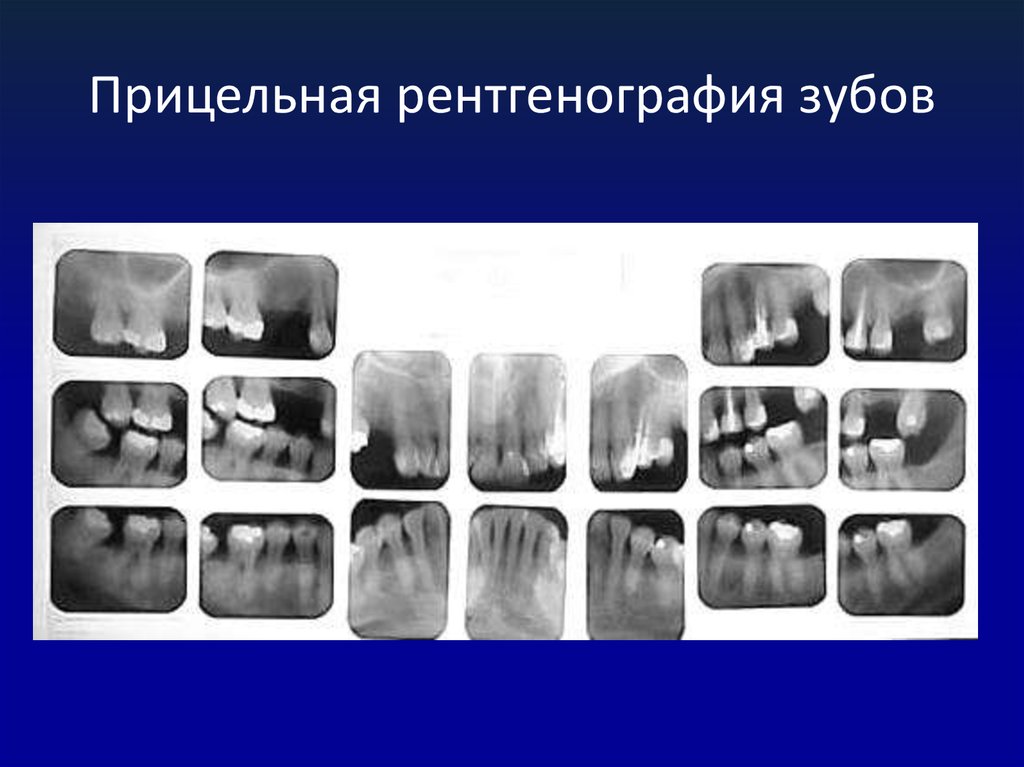 Схема чтения рентгенограмм в стоматологии