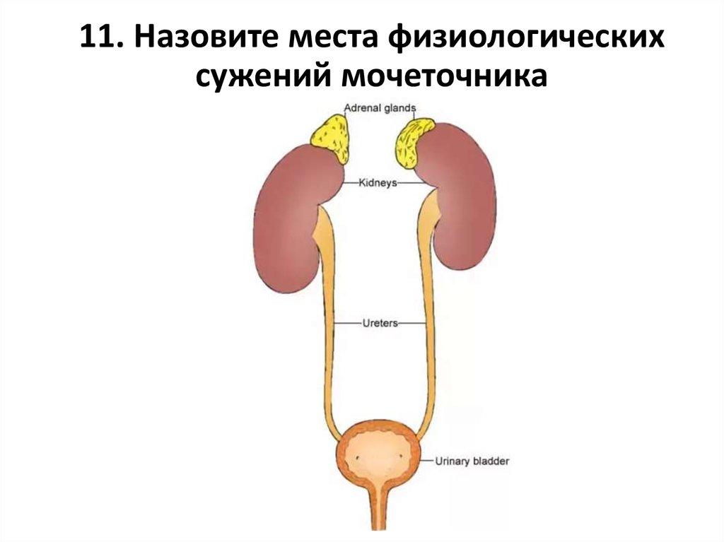 Стриктура мочеточника операция