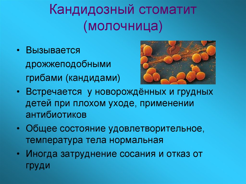 Возбудители после 60. Кандидозный стоматит препараты. Возбудитель кандидозного стоматита. Кандидозный стоматит препараты для лечения детям. Клинические проявления кандидозного стоматита.