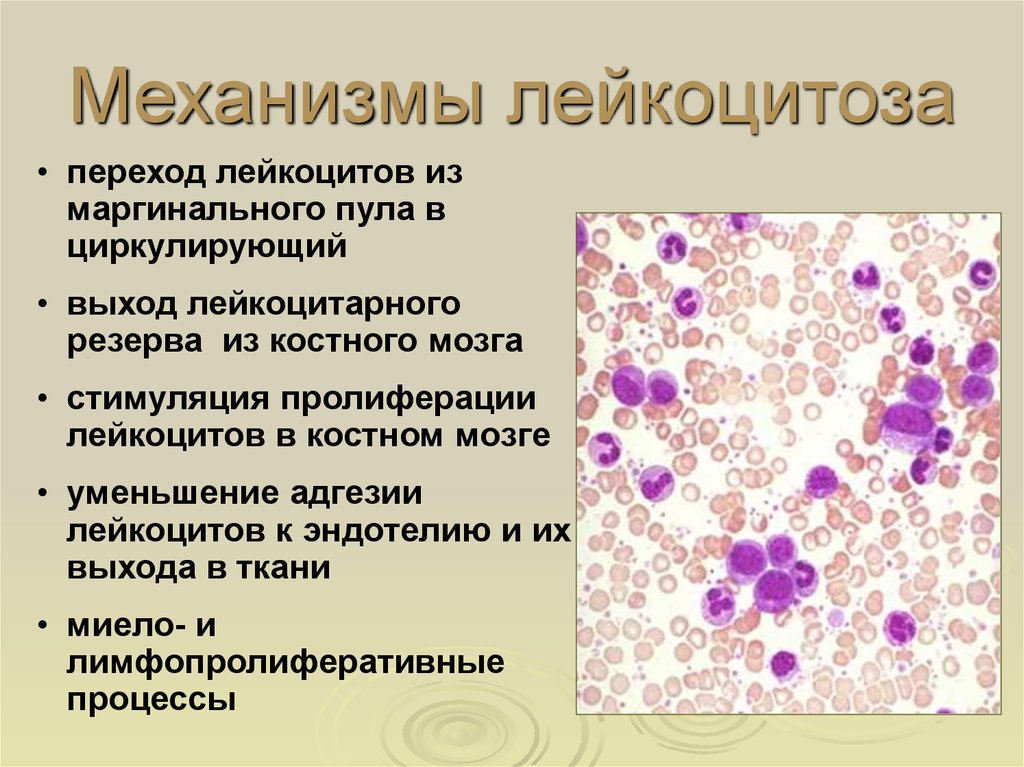 Реактивные изменения лейкоцитов. Механизм развития лейкоцитоза. Лейкоцитоз 54. Эозинофильный лейкоцитоз механизм. Эозинофильный лейкоцитоз механизмы развития.