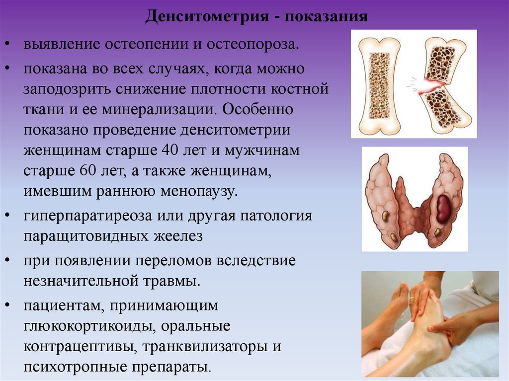 Денситометрия костей. Денситометрия остеопения остеопороз. Остеопороз рентгенологическая денситометрия. Денситометрии костей при остеопорозе. Показания к денситометрии костей.