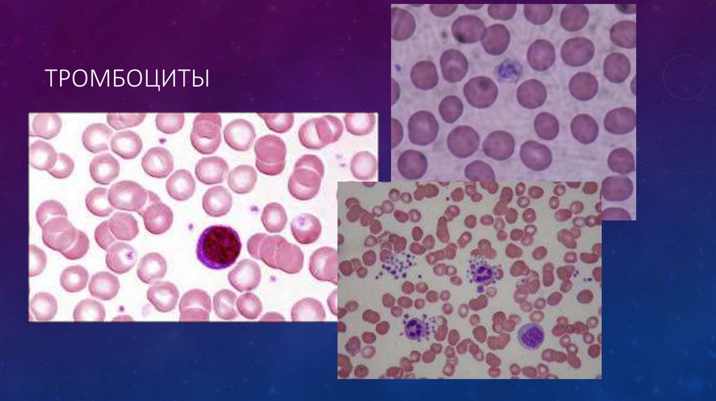 Тромбоциты в мазке крови фото