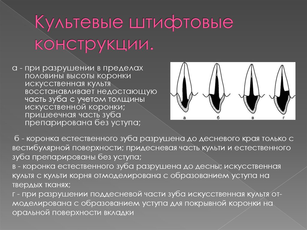 Вкладки ортопедическая стоматология презентация