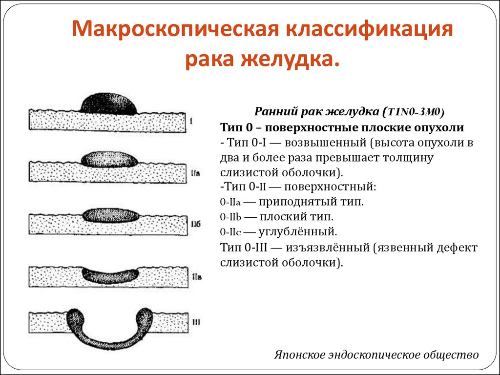 Ямочный рисунок полипа