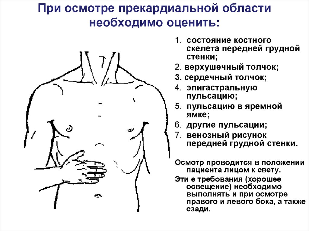 Эпигастральная боль