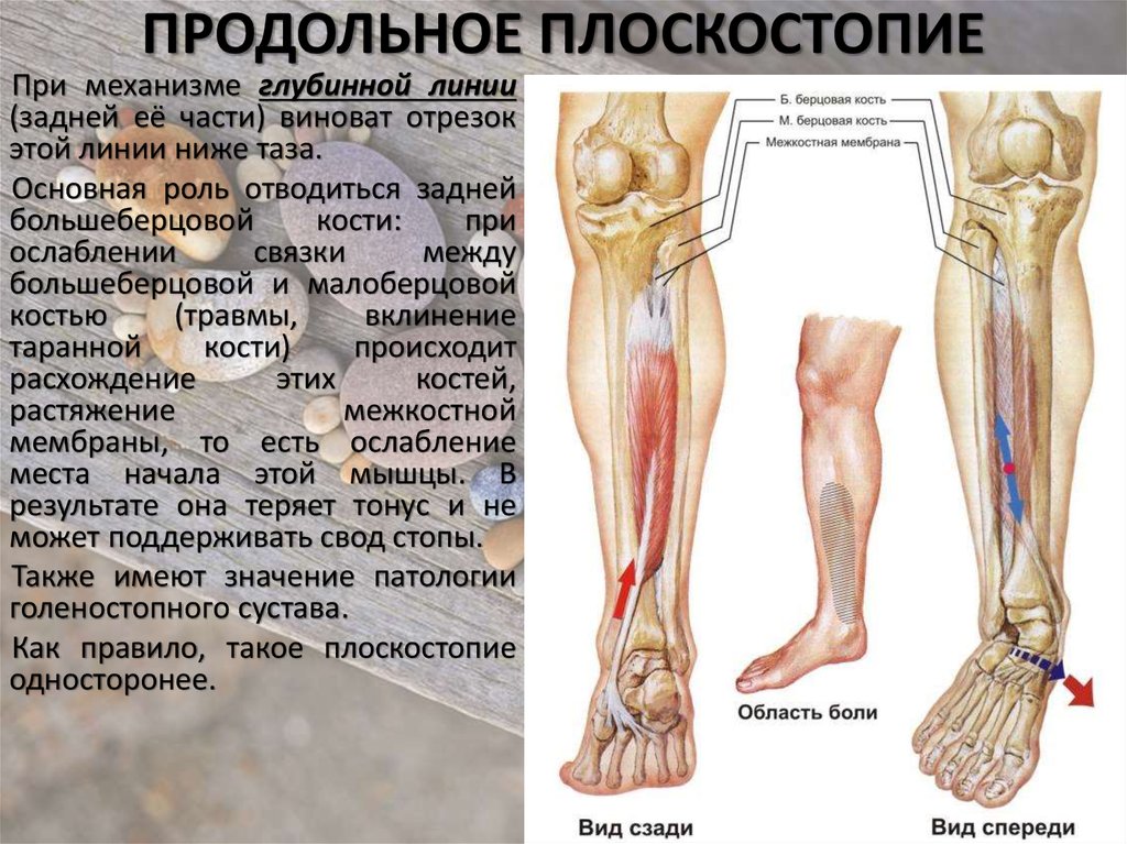 Болят кости причина