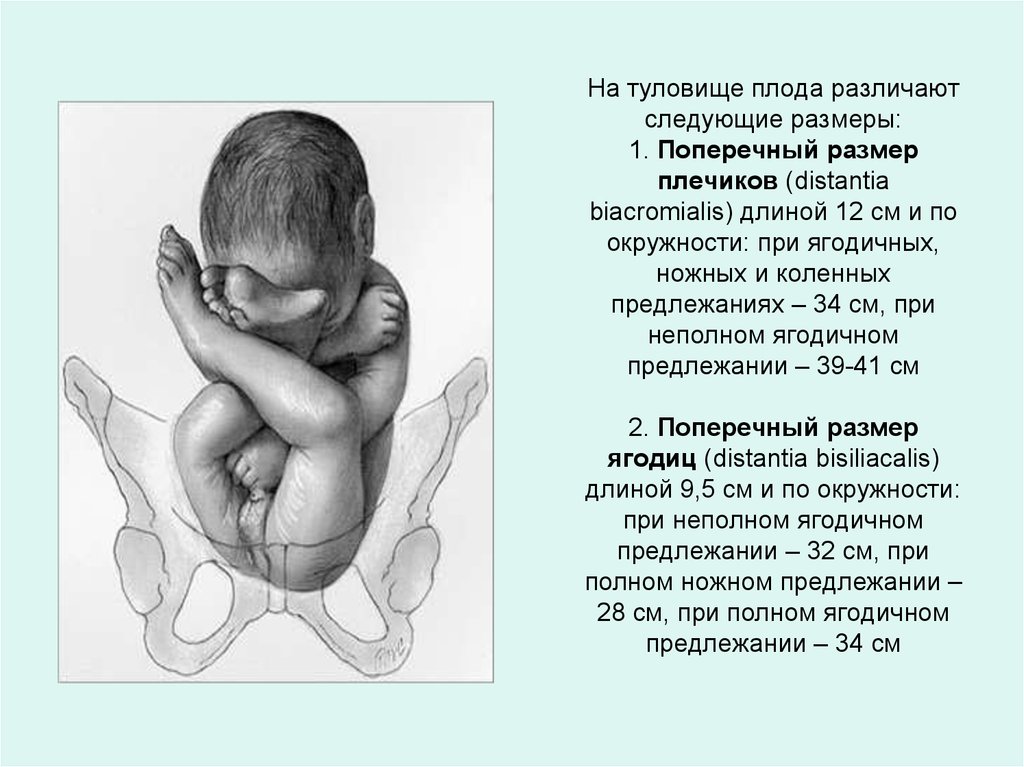 Вес ребенка в 31 неделю. Вес ребенка на 32 неделе беременности по УЗИ. Бипариетальный размер головки плода. Размер малыша на 32 неделе беременности. Вес ребёнка в 32 недели беременности.