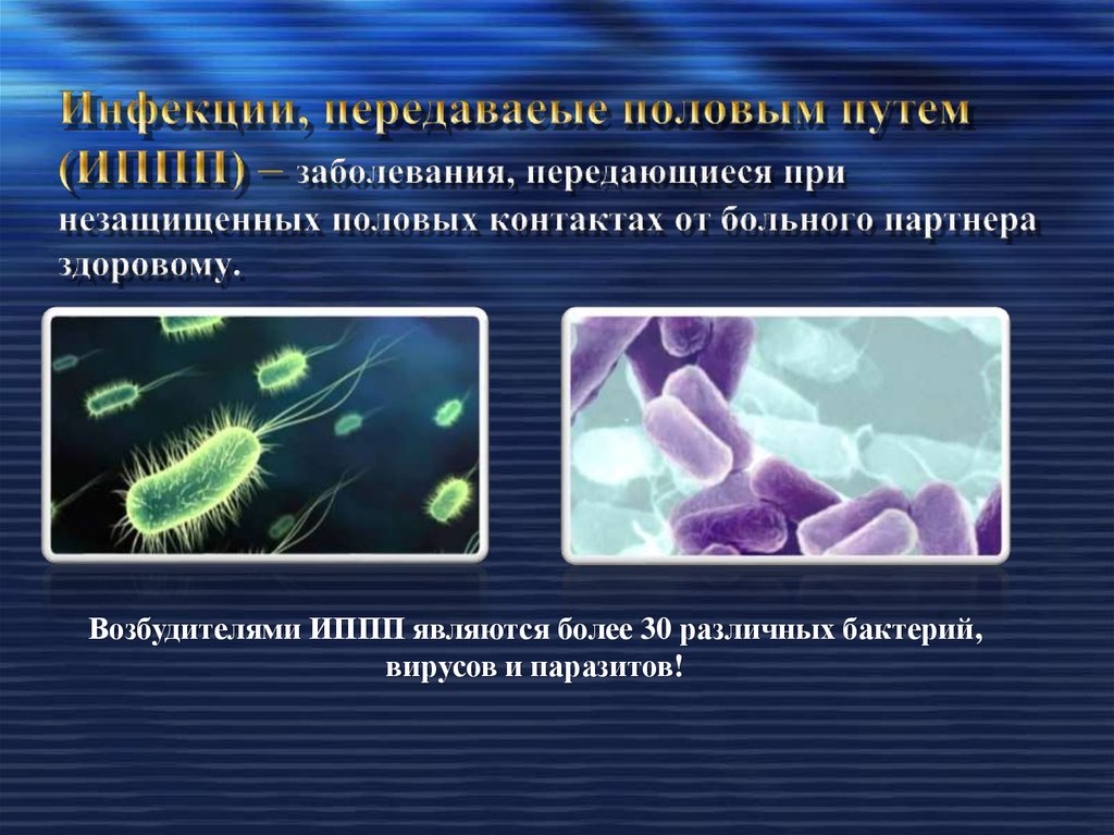 Инфекции передаваемые половым путем презентация