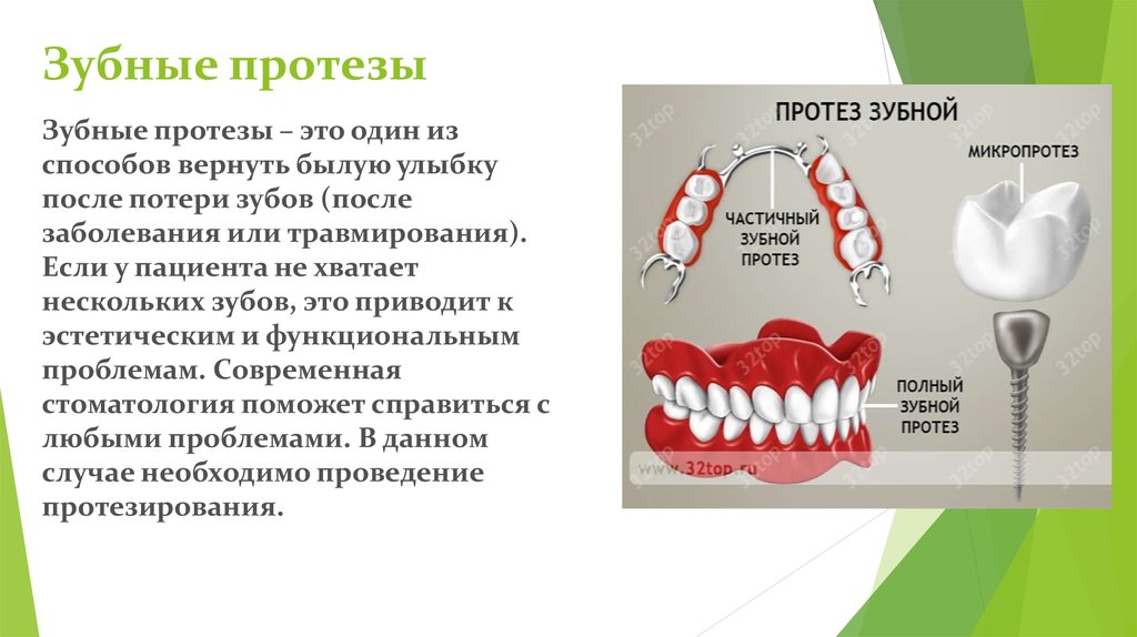 Виды ортопедического лечения. Зубные протезы для презентации. Протезы в стоматологии ppt.