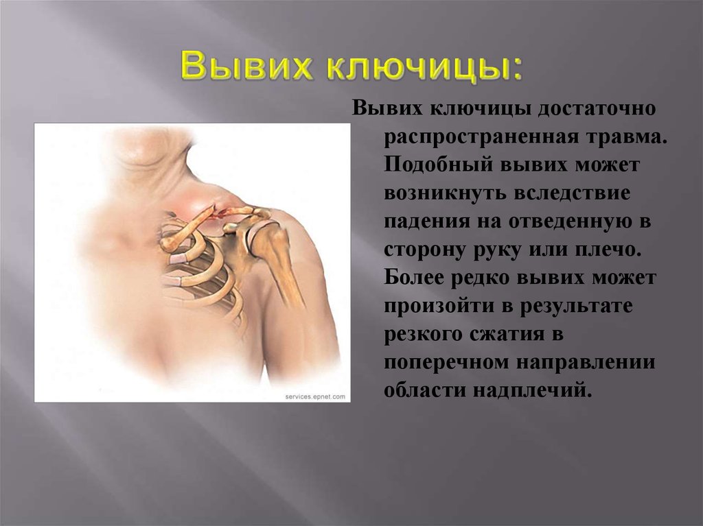 Боль в ключице