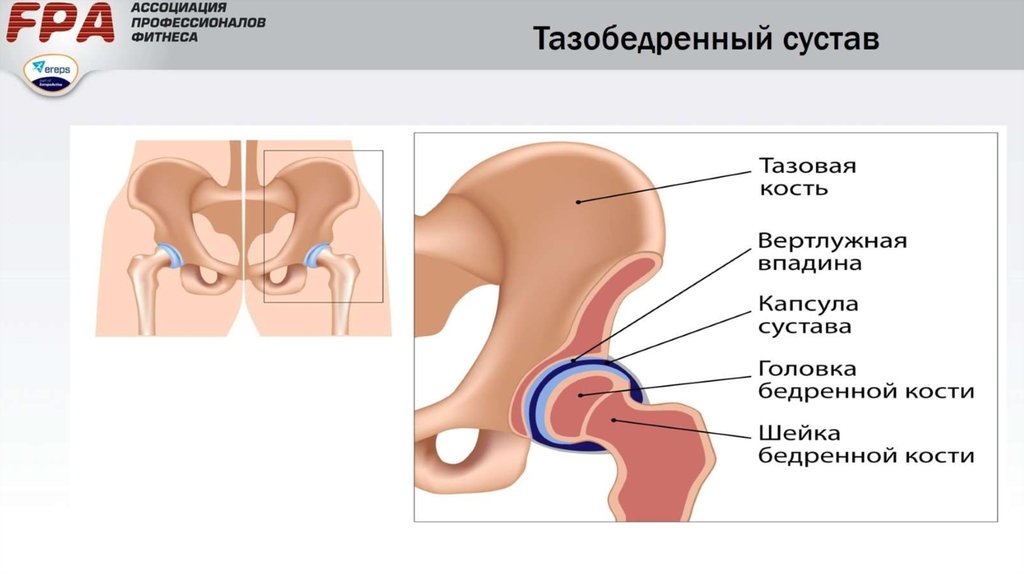 Перелом вертлужной впадины презентация