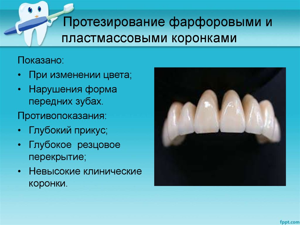 Искусственные зубы презентация