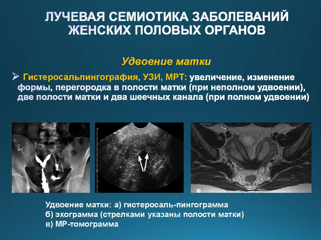 Диагностика матки. Аномалии женских половых органов. Ультразвуковое исследование женских половых органов.