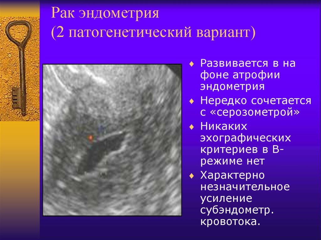 Абляция эндометрия матки что это такое фото