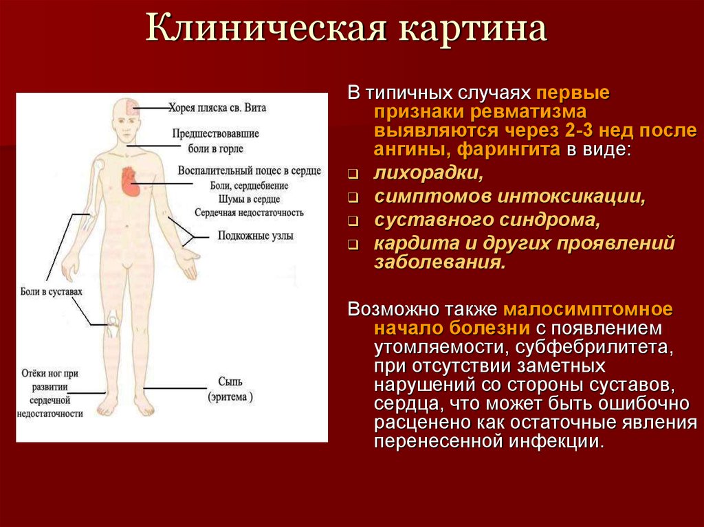 Острая ревматическая лихорадка у детей картинки