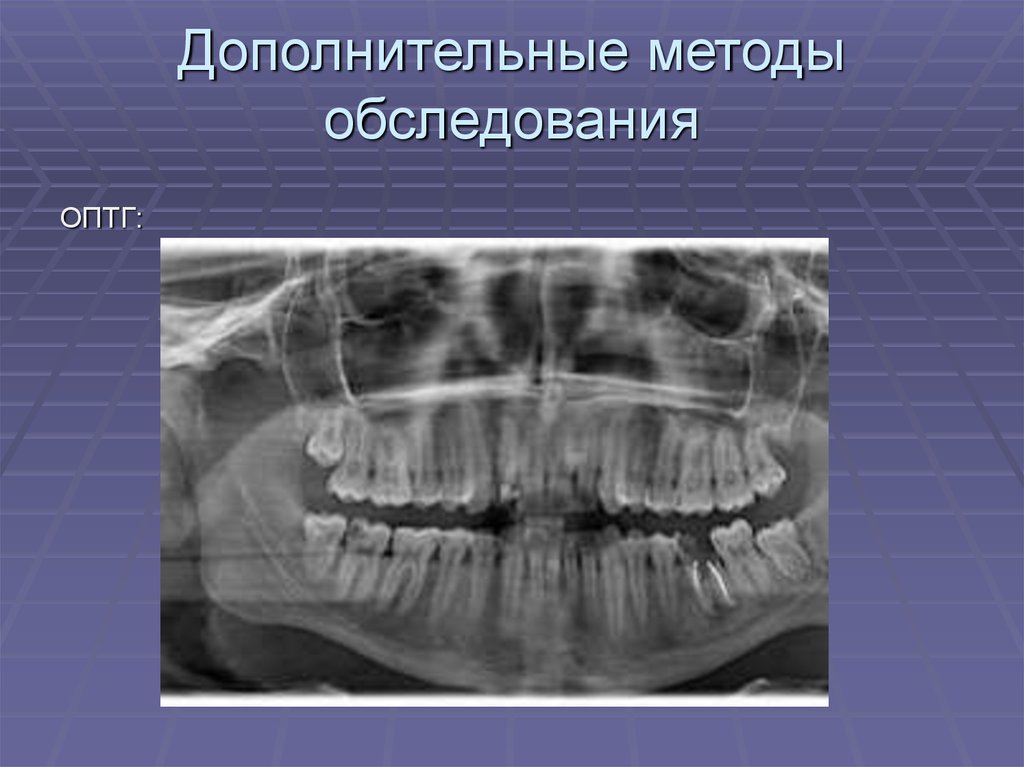 Схема описания оптг