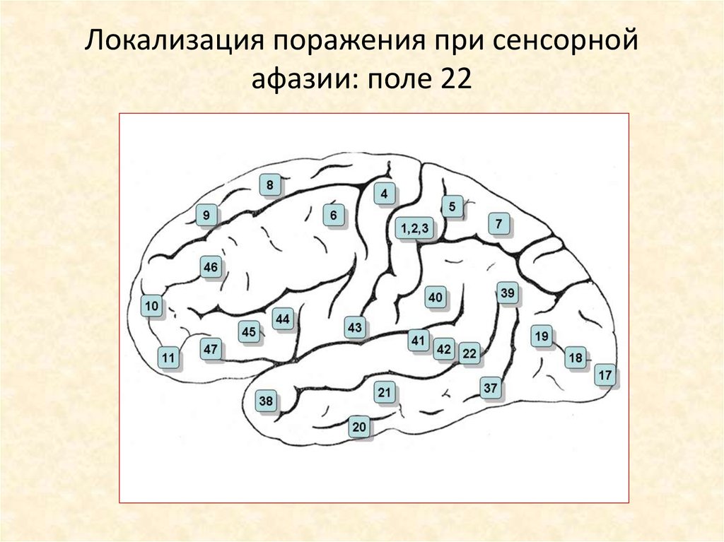 Локализация поражения. Сенсорная афазия зона поражения. Сенсорная афазия очаг. Сенсорная афазия очаг поражения. Сенсорная афазия Вернике.